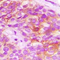ELOVL5 Rabbit Polyclonal Antibody