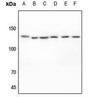 EPHA2 Rabbit Polyclonal Antibody