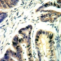 EPHA2 Rabbit Polyclonal Antibody