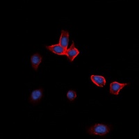 EPHA2 Rabbit Polyclonal Antibody