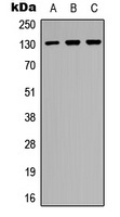 EPHB2 Rabbit Polyclonal Antibody