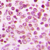 GPR43 Rabbit Polyclonal Antibody