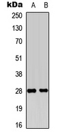 FGF19 Rabbit Polyclonal Antibody