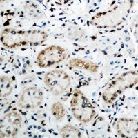 FGF19 Rabbit Polyclonal Antibody