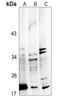FGF22 Rabbit Polyclonal Antibody