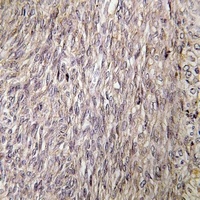FGF22 Rabbit Polyclonal Antibody