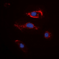 FGF22 Rabbit Polyclonal Antibody