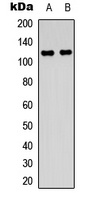 FGFR1 Rabbit Polyclonal Antibody