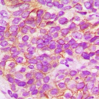 FGFR1 Rabbit Polyclonal Antibody