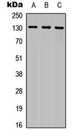 CD135 Rabbit Polyclonal Antibody