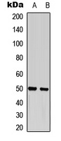 GFAP (Phospho-S38) Rabbit Polyclonal Antibody