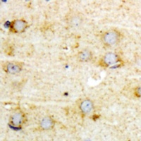 GFAP (Phospho-S38) Rabbit Polyclonal Antibody