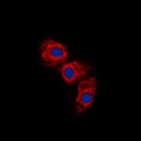 GFAP (Phospho-S38) Rabbit Polyclonal Antibody