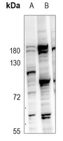 GPR97 Rabbit Polyclonal Antibody