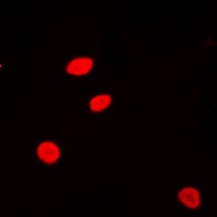 Histone H2A.Z (Acetyl-K5) Rabbit Polyclonal Antibody