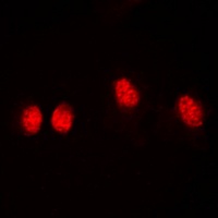 Histone Deacetylase 3 (Phospho-S424) Rabbit Polyclonal Antibody