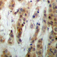 HEXIM1 Rabbit Polyclonal Antibody