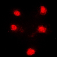 HEXIM1 Rabbit Polyclonal Antibody