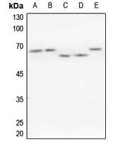 hnRNP K Rabbit Polyclonal Antibody