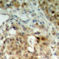 hnRNP K Rabbit Polyclonal Antibody