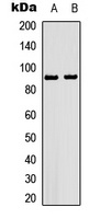HSP90 beta (Phospho-S226) Rabbit Polyclonal Antibody