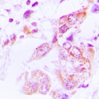 HSP90 beta (Phospho-S226) Rabbit Polyclonal Antibody