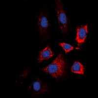 HSP90 beta (Phospho-S226) Rabbit Polyclonal Antibody