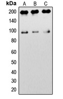 IGF1 Receptor Rabbit Polyclonal Antibody