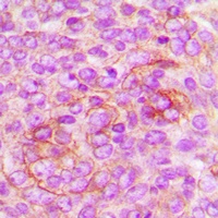 CD222 Rabbit Polyclonal Antibody
