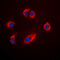 CD222 Rabbit Polyclonal Antibody