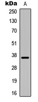 IGFBP1 Rabbit Polyclonal Antibody