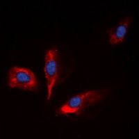 IGFBP1 Rabbit Polyclonal Antibody