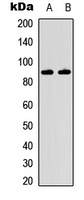IKK beta Rabbit Polyclonal Antibody