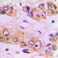 IKK beta Rabbit Polyclonal Antibody