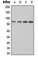IKK beta Rabbit Polyclonal Antibody