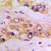 IKK beta Rabbit Polyclonal Antibody