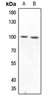 CD210a Rabbit Polyclonal Antibody