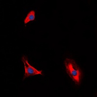 CD210a Rabbit Polyclonal Antibody