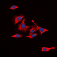 CD213a1 (Phospho-Y405) Rabbit Polyclonal Antibody