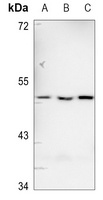 CD213a1 Rabbit Polyclonal Antibody