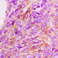 CD213a1 Rabbit Polyclonal Antibody