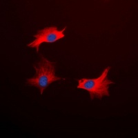 CD213a1 Rabbit Polyclonal Antibody