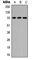 CD122 (Phospho-Y364) Rabbit Polyclonal Antibody
