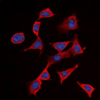 CD122 (Phospho-Y364) Rabbit Polyclonal Antibody