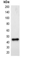 mCherry-tag Mouse Monoclonal Antibody