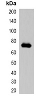 mCherry-tag Rabbit Polyclonal Antibody