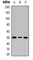 Beta3-tubulin Mouse Monoclonal Antibody