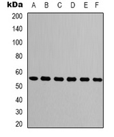 Beta-tubulin Mouse Monoclonal Antibody