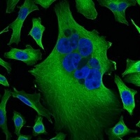 Beta-tubulin Mouse Monoclonal Antibody