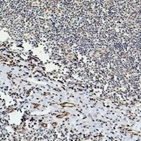 Beta-tubulin Mouse Monoclonal Antibody